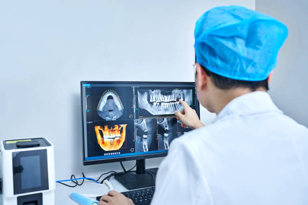 Best Emergency Wisdom Teeth Removal in South San Francisco, CA